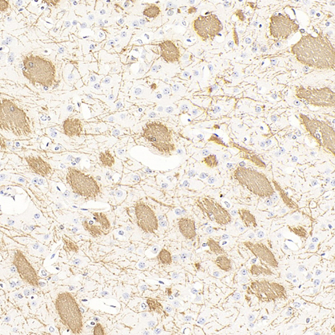 Immunohistochemistry analysis of paraffin-embedded mouse brain  using MBP Polyclonal Antibody at dilution of 1:300.