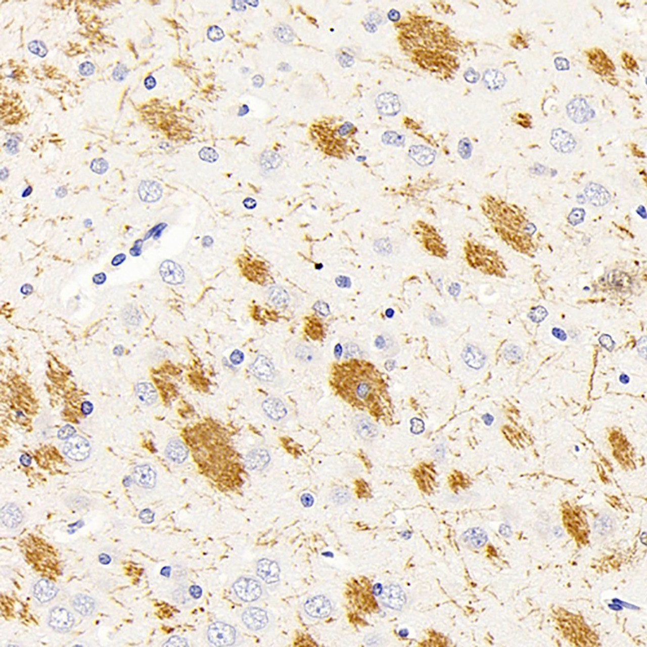 Immunohistochemistry analysis of paraffin-embedded rat brain  using MBP Polyclonal Antibody at dilution of 1:500.