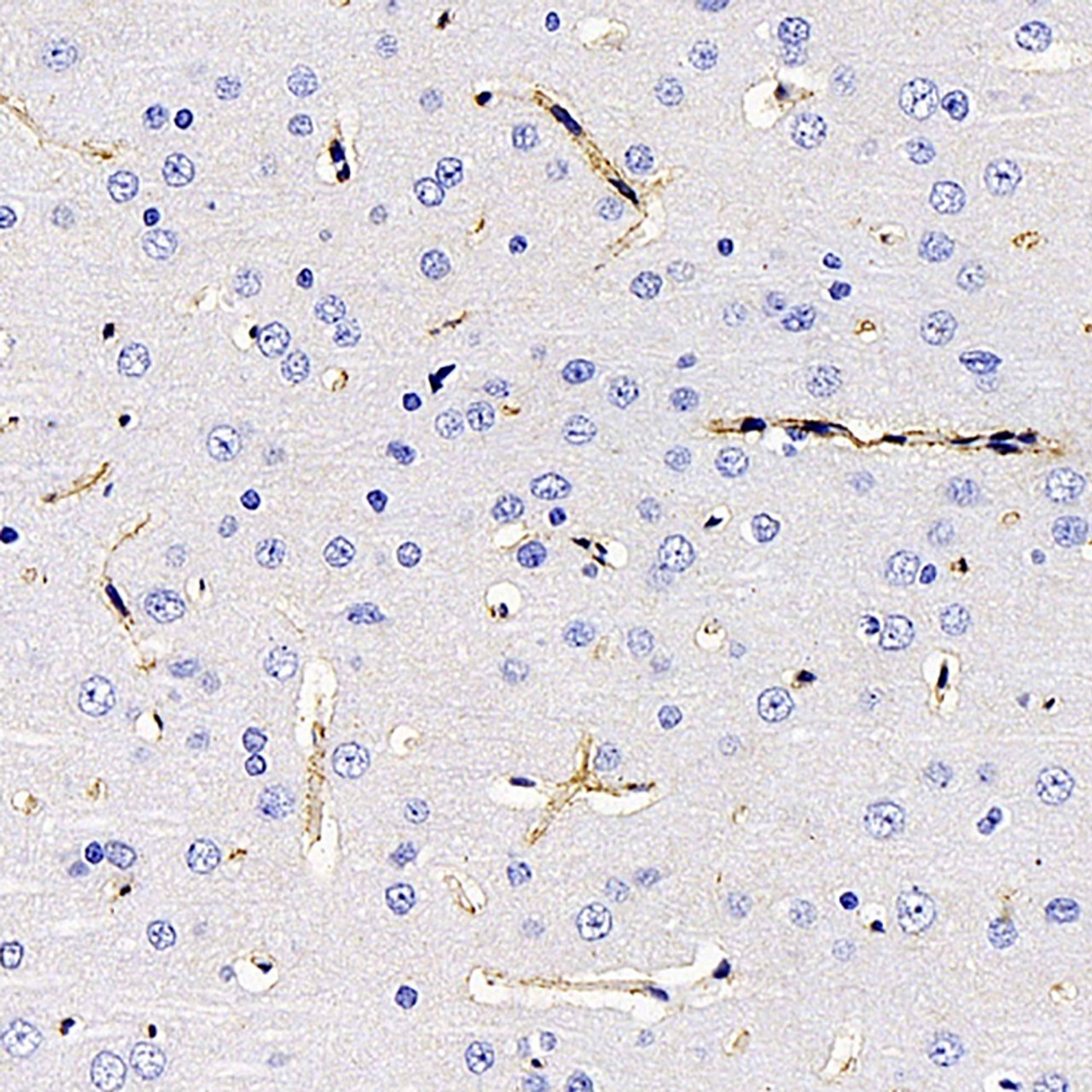 Immunohistochemistry analysis of paraffin-embedded rat brain  using AQP4 Polyclonal Antibody at dilution of 1:400.