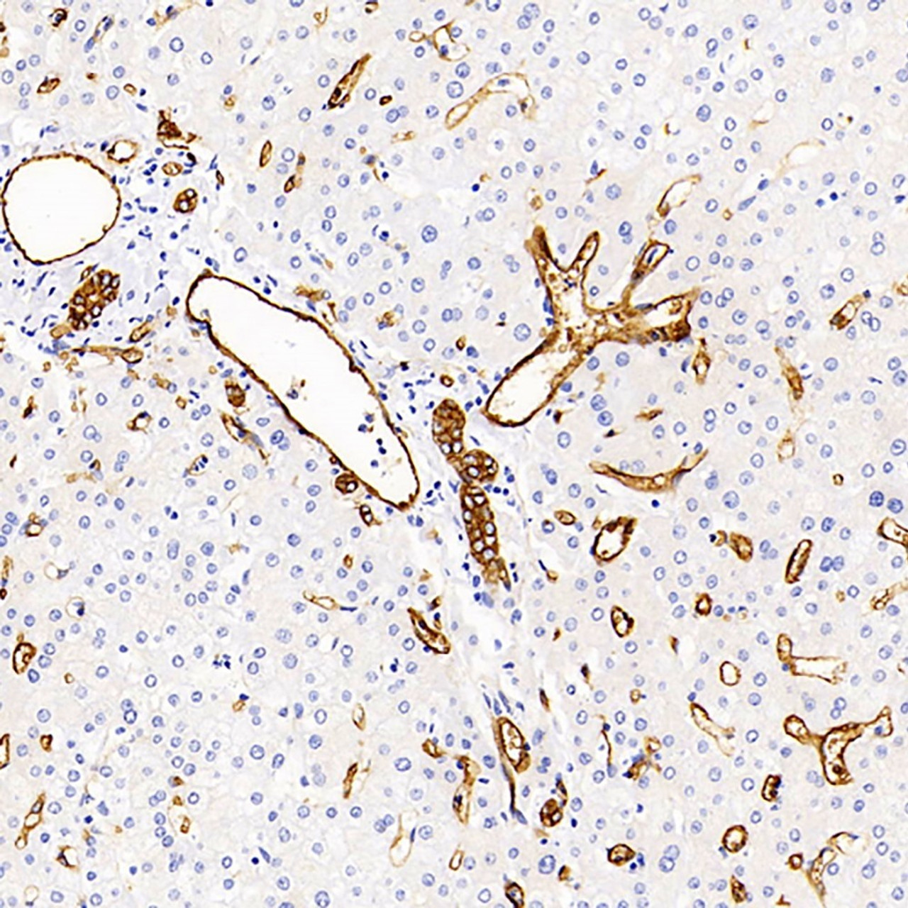 Immunohistochemistry analysis of paraffin-embedded human liver  using AQP1 Polyclonal Antibody at dilution of 1:400.
