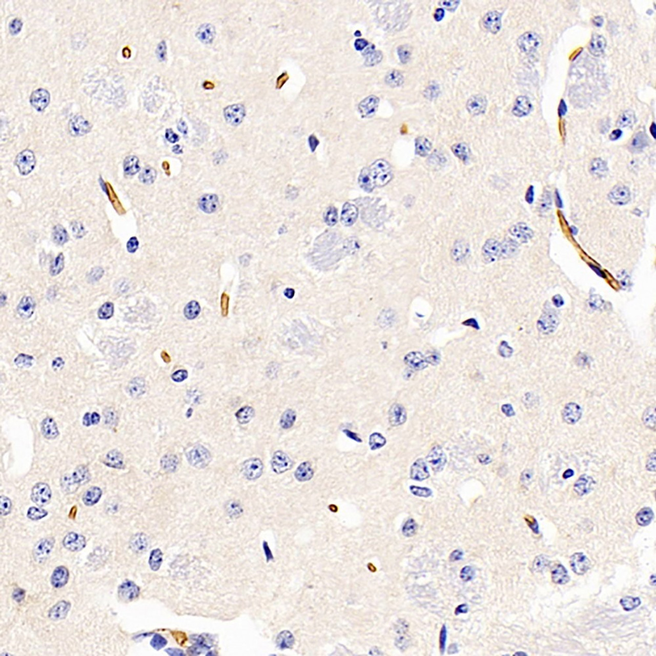 Immunohistochemistry analysis of paraffin-embedded Mouse brain  using AQP1 Polyclonal Antibody at dilution of 1:400.