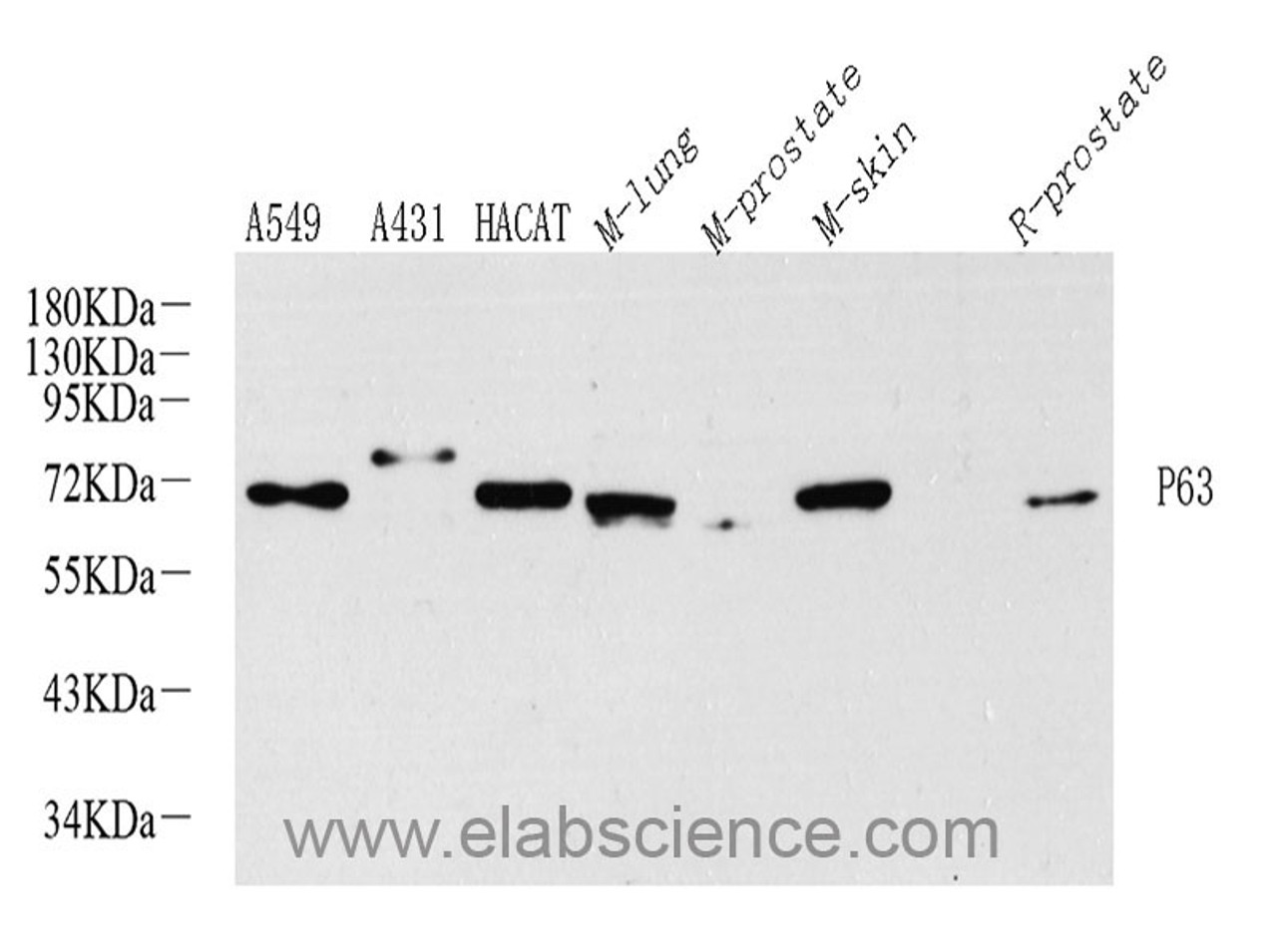 Western Blot analysis of various samples using p63 Polyclonal Antibody at dilution of 1:1000.
