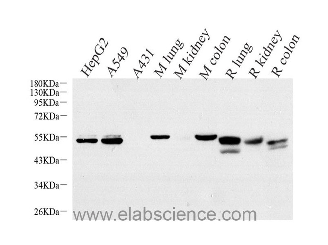Western Blot analysis of various samples using CK-7 Monoclonal Antibody at dilution of 1:1000.