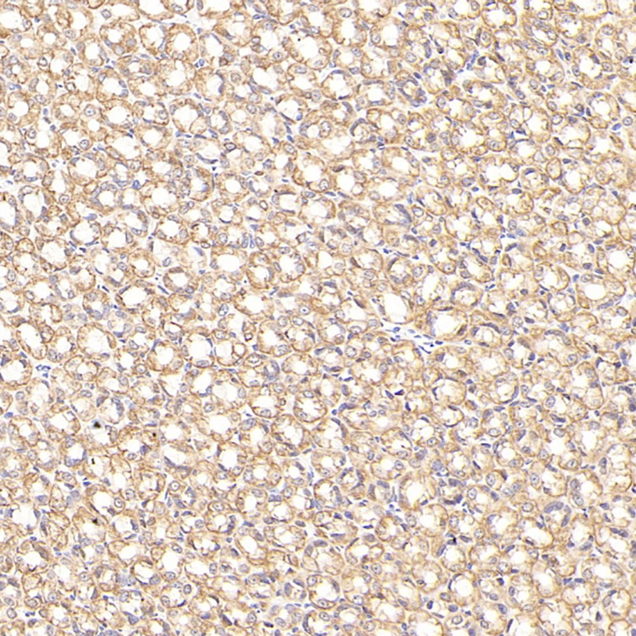 Immunohistochemistry analysis of paraffin-embedded Rat stomach cancer  using CK-7 Monoclonal Antibody at dilution of 1:300.