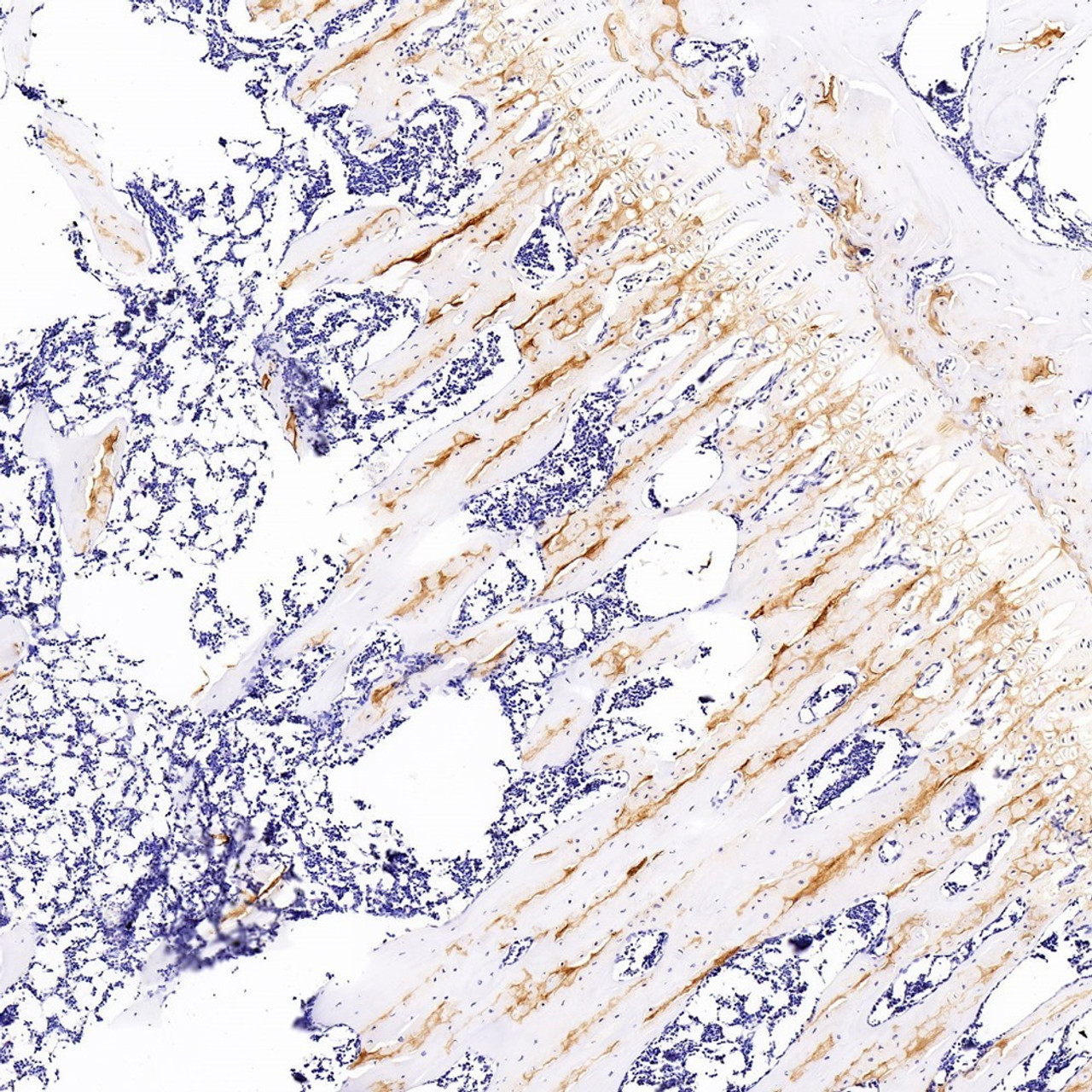 Immunohistochemistry analysis of paraffin-embedded rat bone  using COL2A1 Monoclonal Antibody at dilution of 1:300.