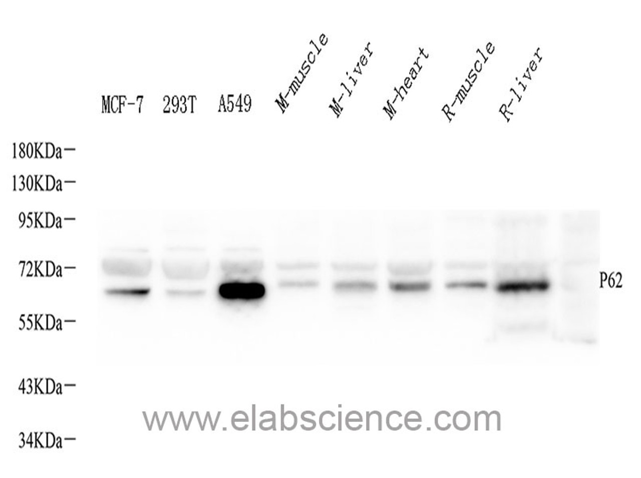 Western Blot analysis of various samples using P62/SQSTM1 Polyclonal Antibody at dilution of 1:1000.