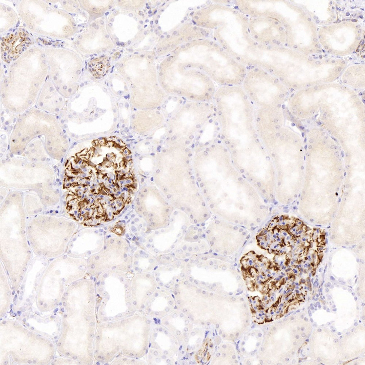 Immunohistochemistry analysis of paraffin-embedded human kidney  using NES Monoclonal Antibody at dilution of 1:400.