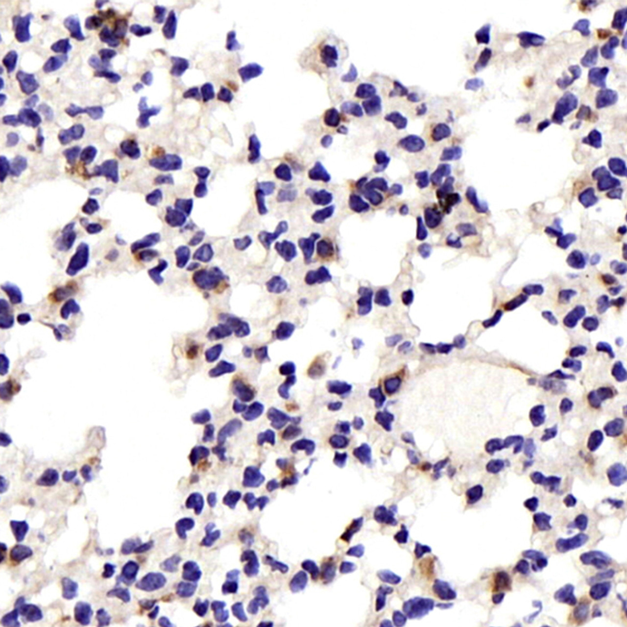 Immunohistochemistry analysis of paraffin-embedded Mouse lung  using JNK1/2/3 Polyclonal Antibody at dilution of 1:200.