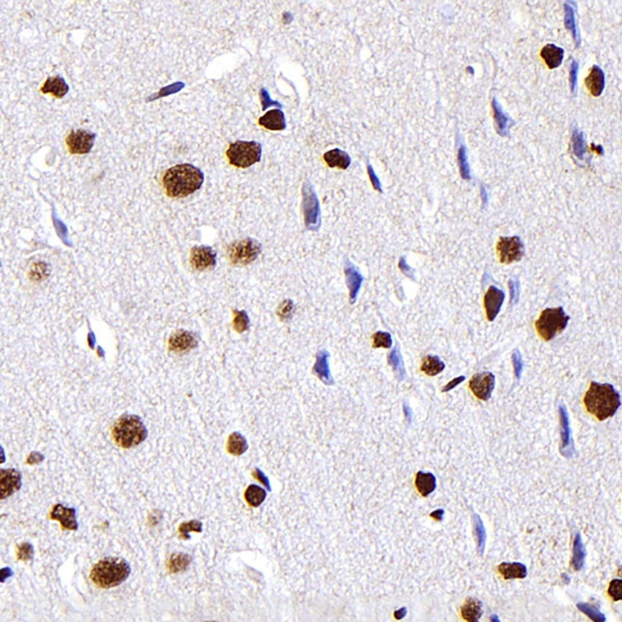 Immunohistochemistry analysis of paraffin-embedded Rat brain  using S100A4 Monoclonal Antibody at dilution of 1:300.