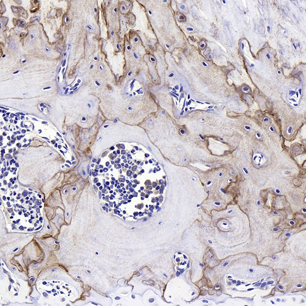 Immunohistochemistry analysis of paraffin-embedded rat bone  using SPP1 Polyclonal Antibody at dilution of 1:400.