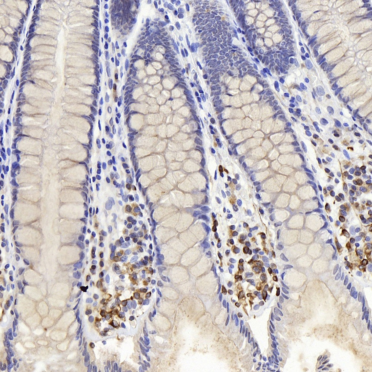 Immunohistochemistry analysis of paraffin-embedded human colon  using Connexin-40 Polyclonal Antibody at dilution of 1:400.