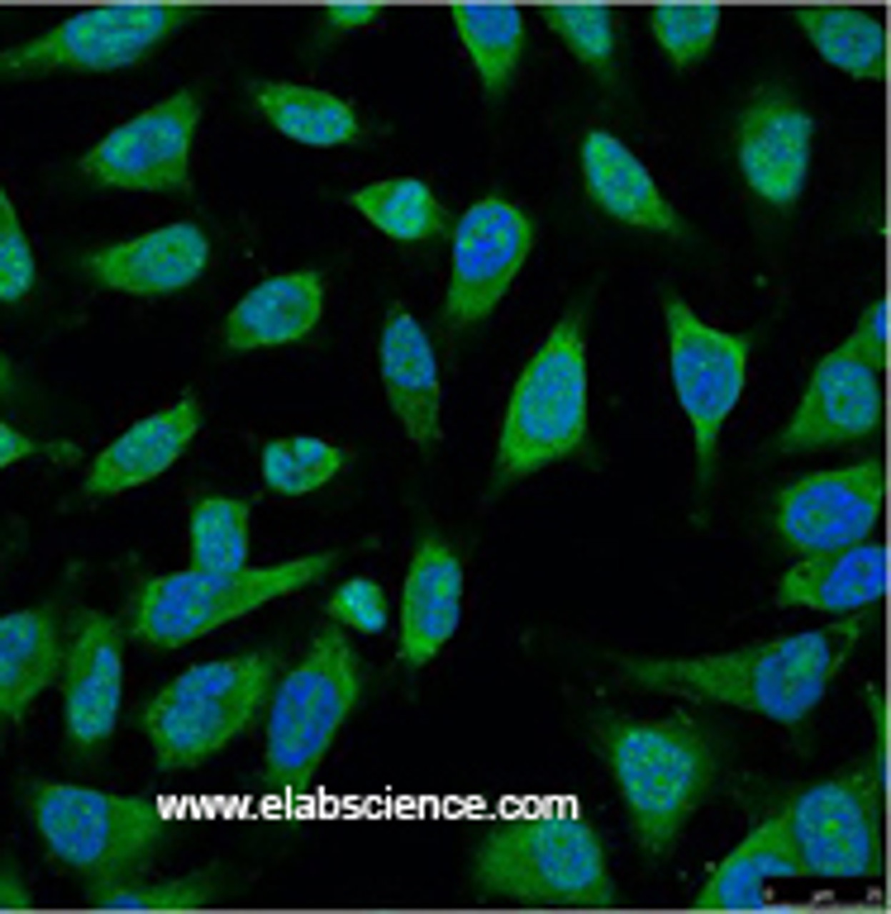Immunofluorescence analysis of Hela tissue using HSP70 Monoclonal Antibody at dilution of 1:100.