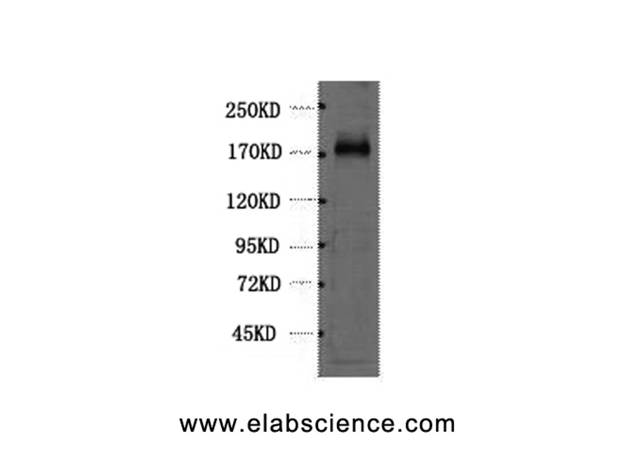 Western Blot analysis of Hela cells using EGFR Monoclonal Antibody at dilution of 1:1000.