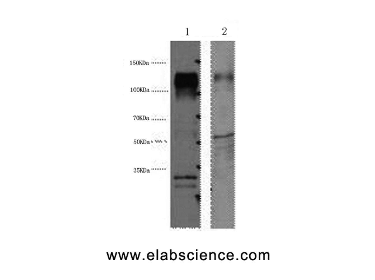Western Blot analysis of 1) Hela, 2) Mouse brain using ERBB2 Monoclonal Antibody at dilution of 1:4000.