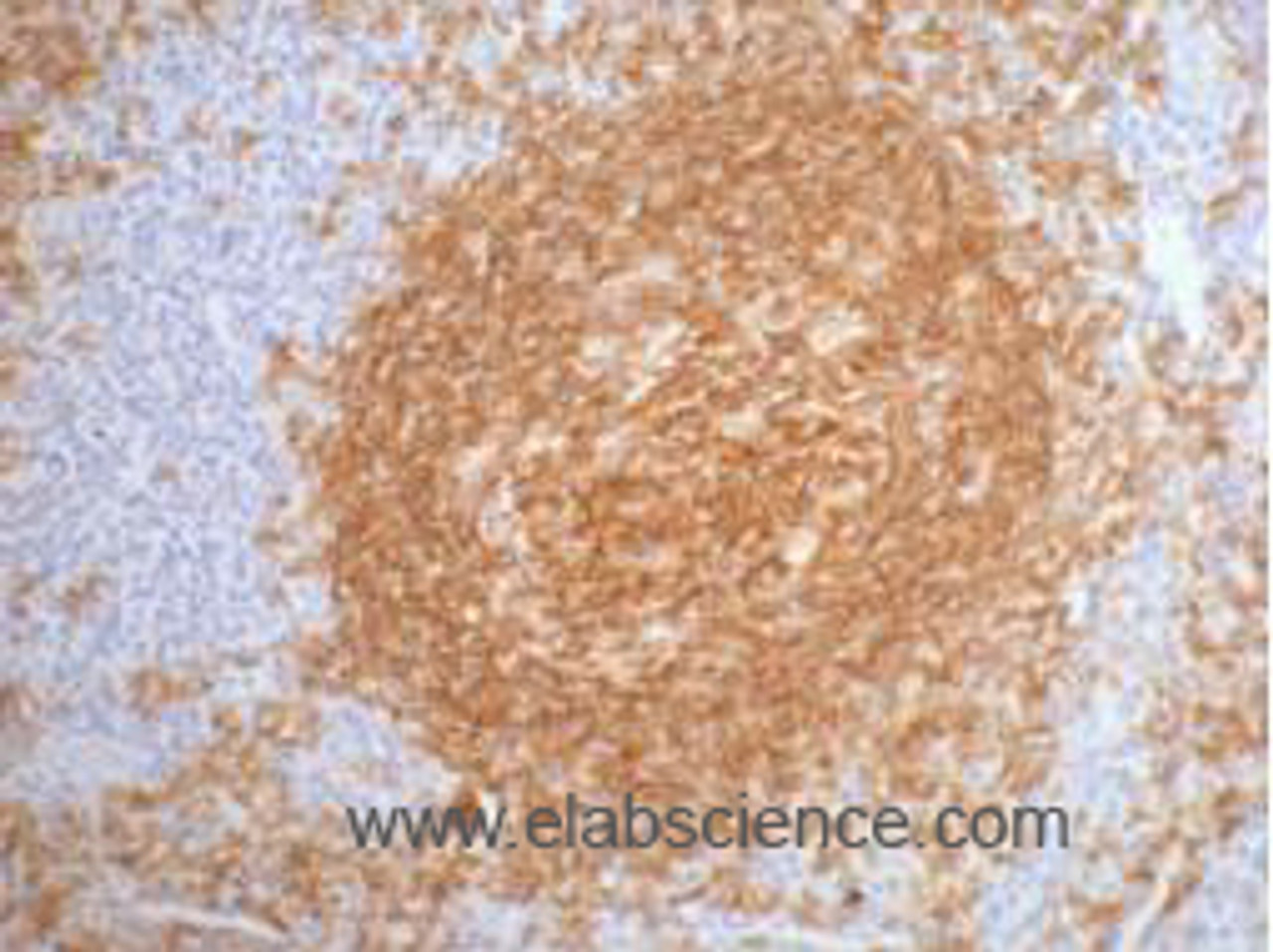 Immunohistochemistry of paraffin-embedded Human tonsil tissue using CD20 Monoclonal Antibody at dilution of 1:200.