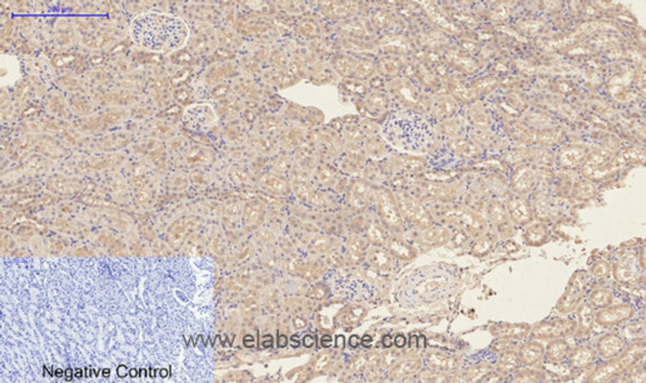 Immunohistochemistry of paraffin-embedded Rat kidney tissue using CD23 Monoclonal Antibody at dilution of 1:200.