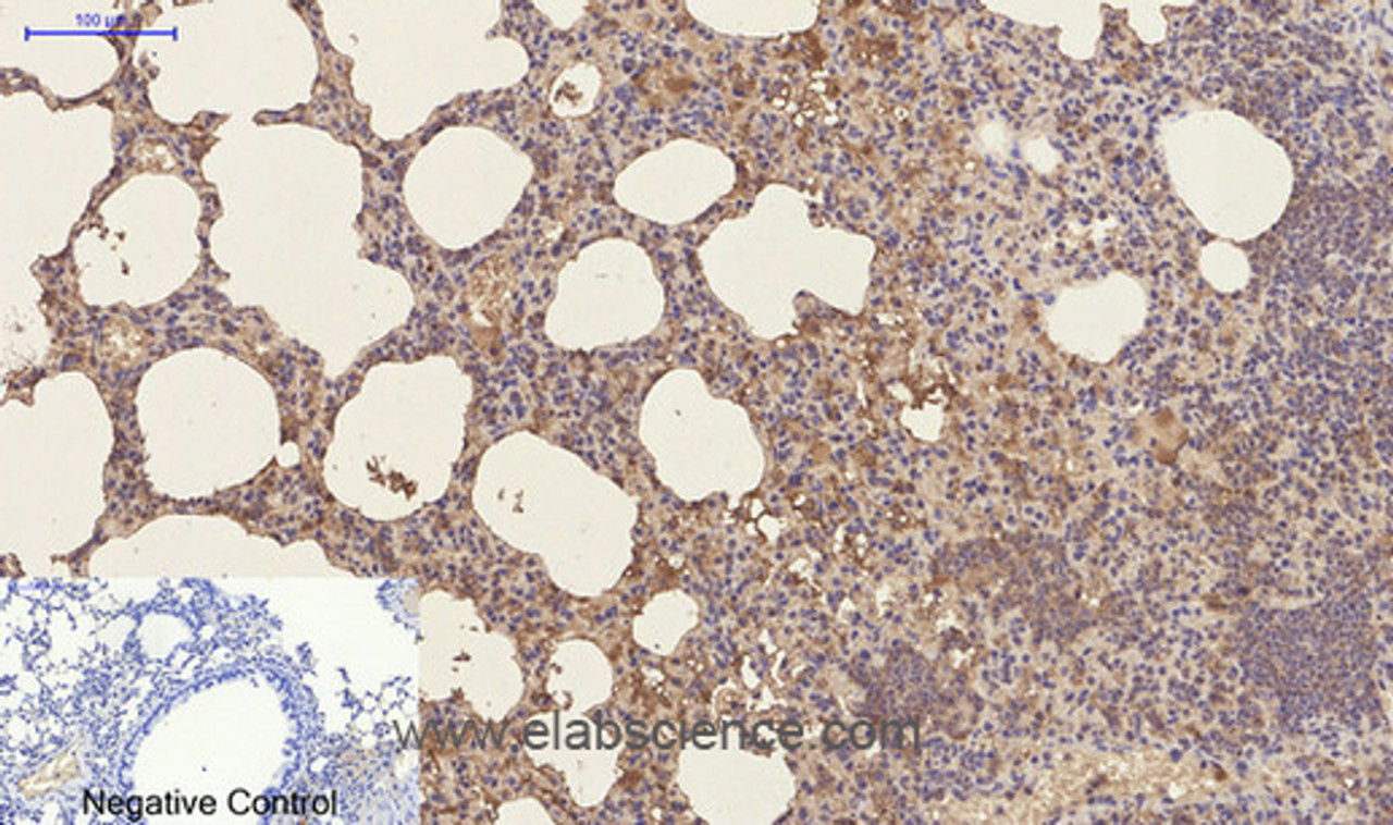 Immunohistochemistry of paraffin-embedded Mouse lung tissue using CD23 Monoclonal Antibody at dilution of 1:200.