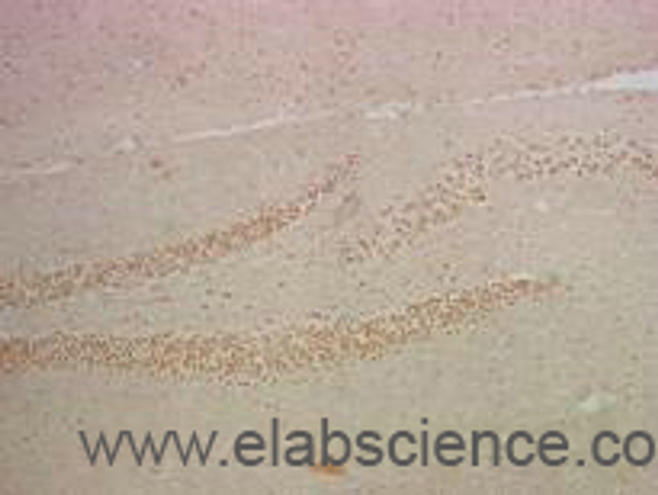 Immunohistochemistry of paraffin-embedded Mouse hippocampus tissue using NFκB-p65 Monoclonal Antibody at dilution of 1:200.