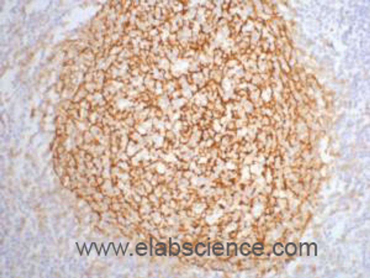 Immunohistochemistry of paraffin-embedded Human tonsil tissue using CD21 Monoclonal Antibody at dilution of 1:200.