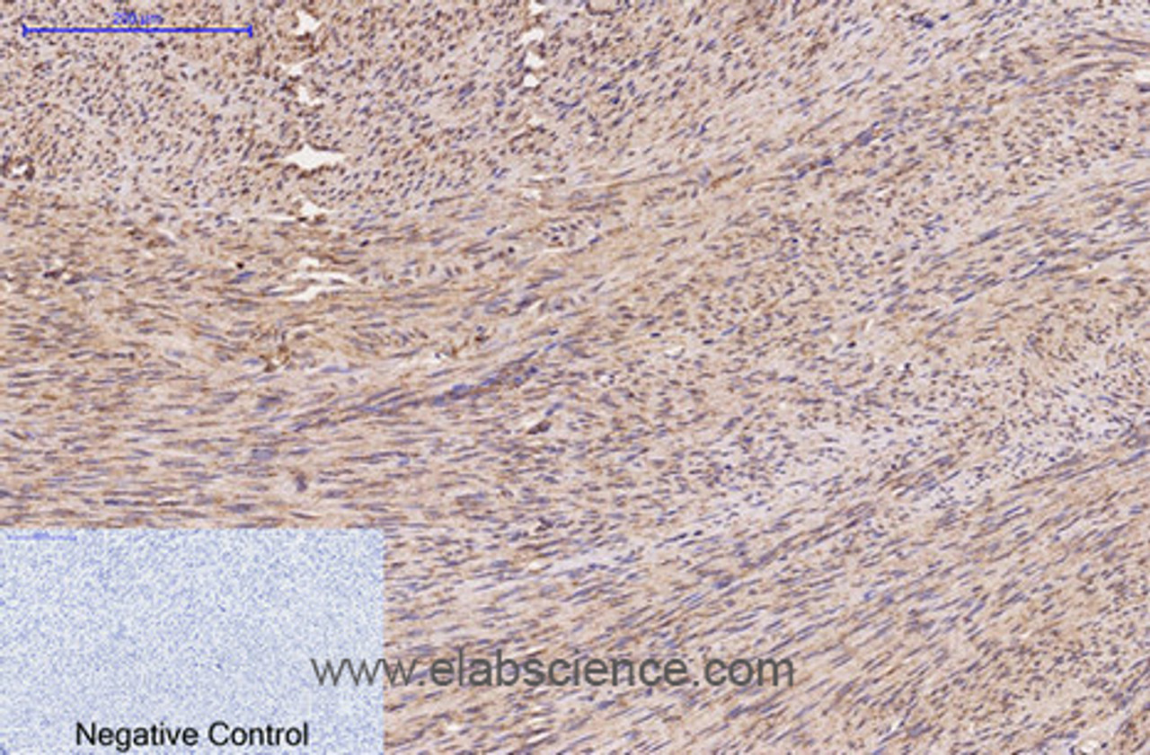 Immunohistochemistry of paraffin-embedded Human uterus tissue using FH Monoclonal Antibody at dilution of 1:200.