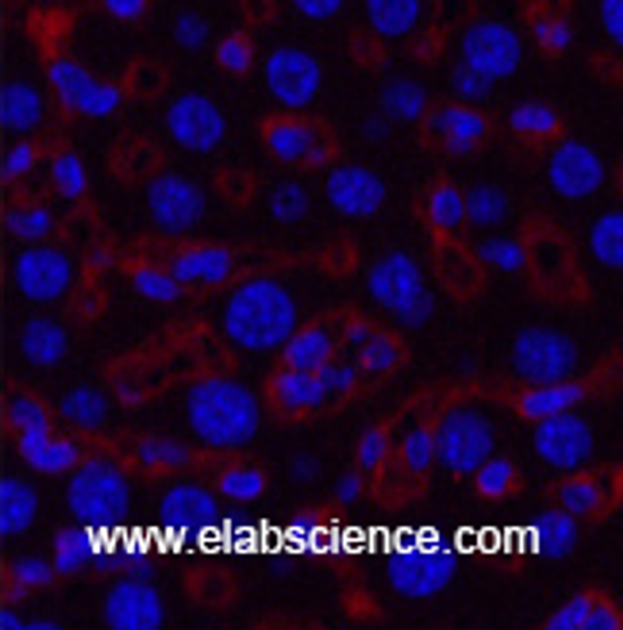 Immunofluorescence analysis of Mouse liver tissue using COL3A1 Monoclonal Antibody at dilution of 1:200.