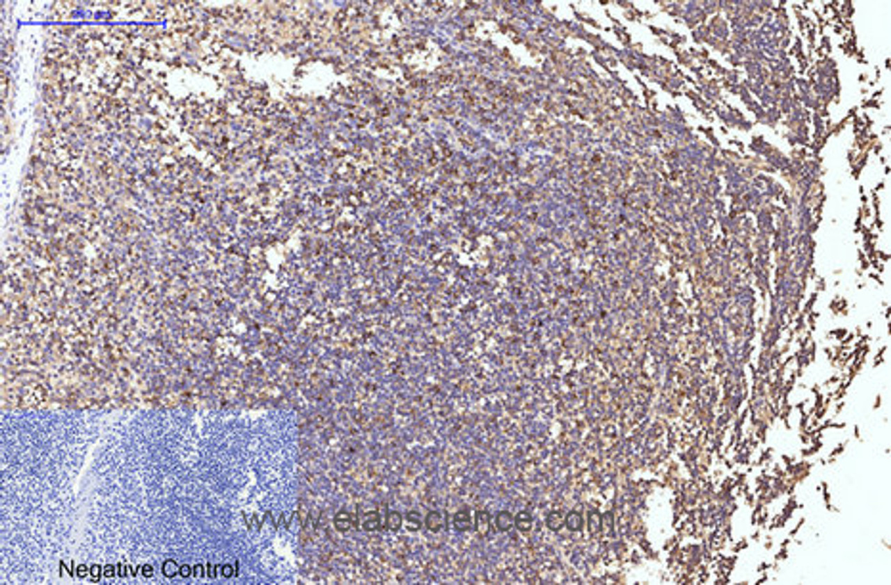 Immunohistochemistry of paraffin-embedded Human tonsil tissue using HSP90 beta Monoclonal Antibody at dilution of 1:200.