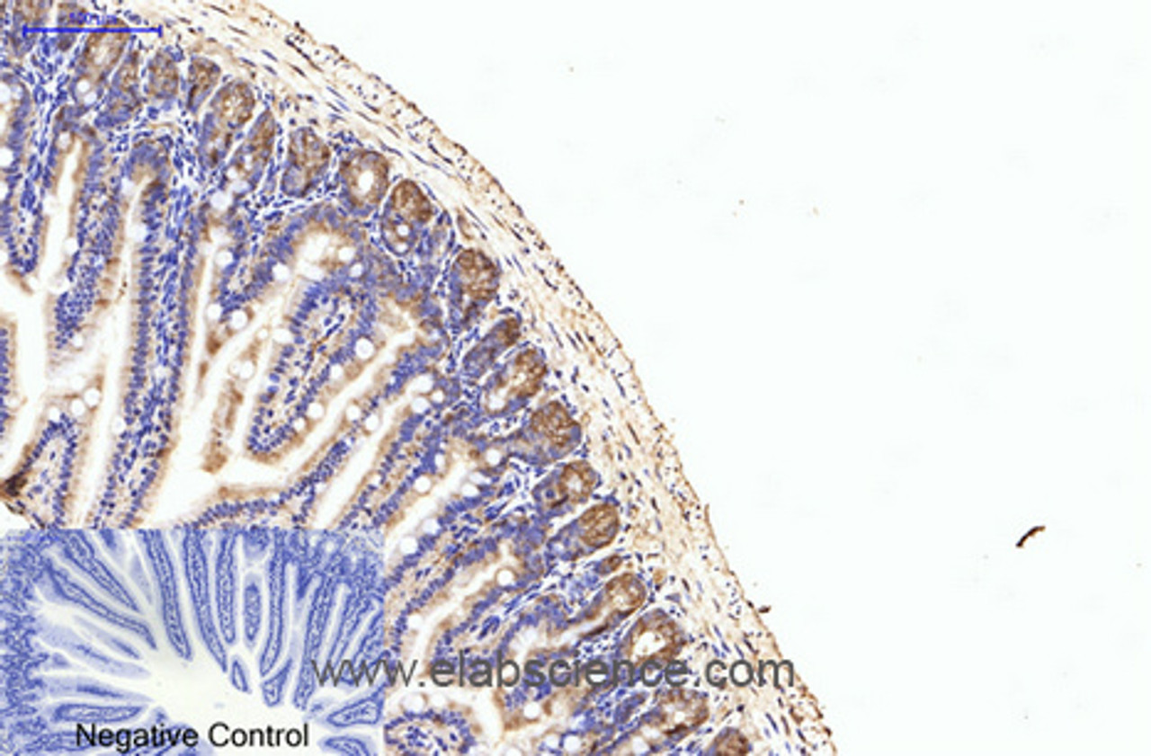 Immunohistochemistry of paraffin-embedded Mouse colon tissue using eIF4A1 Monoclonal Antibody at dilution of 1:200.