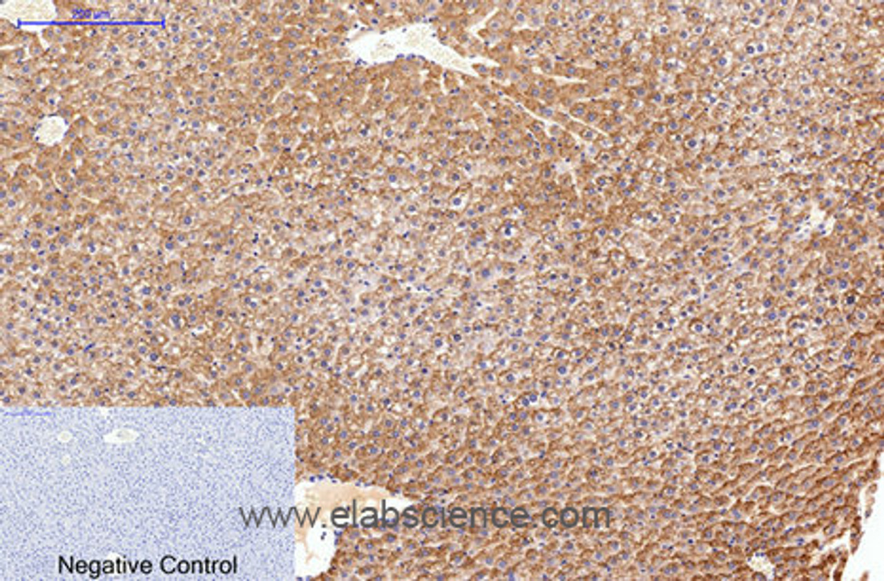 Immunohistochemistry of paraffin-embedded Rat liver tissue using FN1 Monoclonal Antibody at dilution of 1:200.