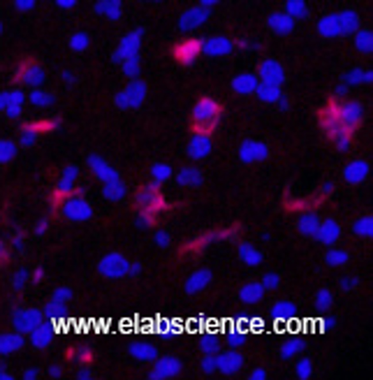 Immunofluorescence analysis of Human appendix tissue using FN1 Monoclonal Antibody at dilution of 1:200.