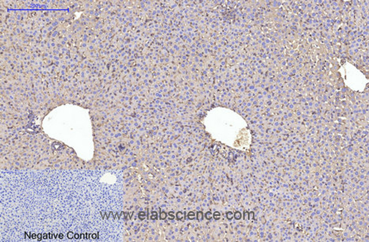 Immunohistochemistry of paraffin-embedded Mouse liver tissue using ACTA1 Monoclonal Antibody at dilution of 1:200.
