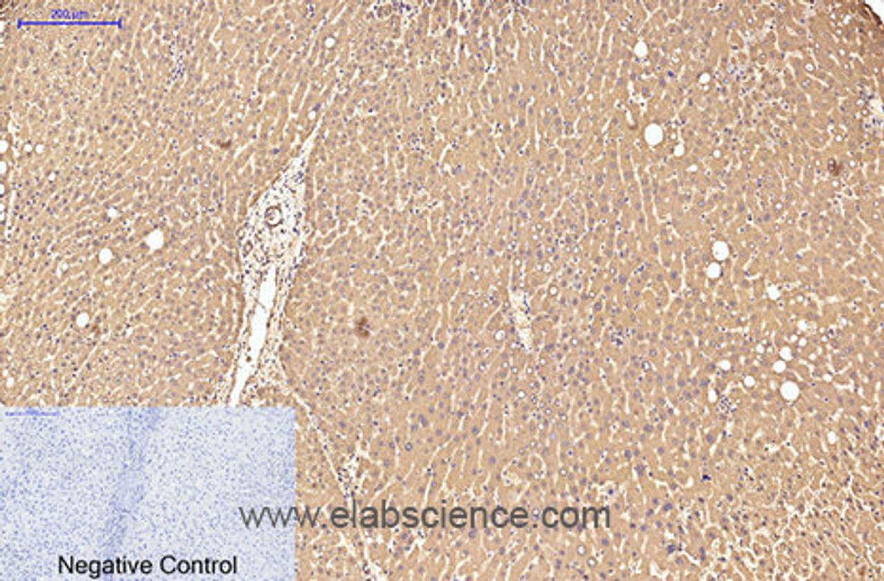 Immunohistochemistry of paraffin-embedded Human liver tissue using Transferrin Monoclonal Antibody at dilution of 1:200.