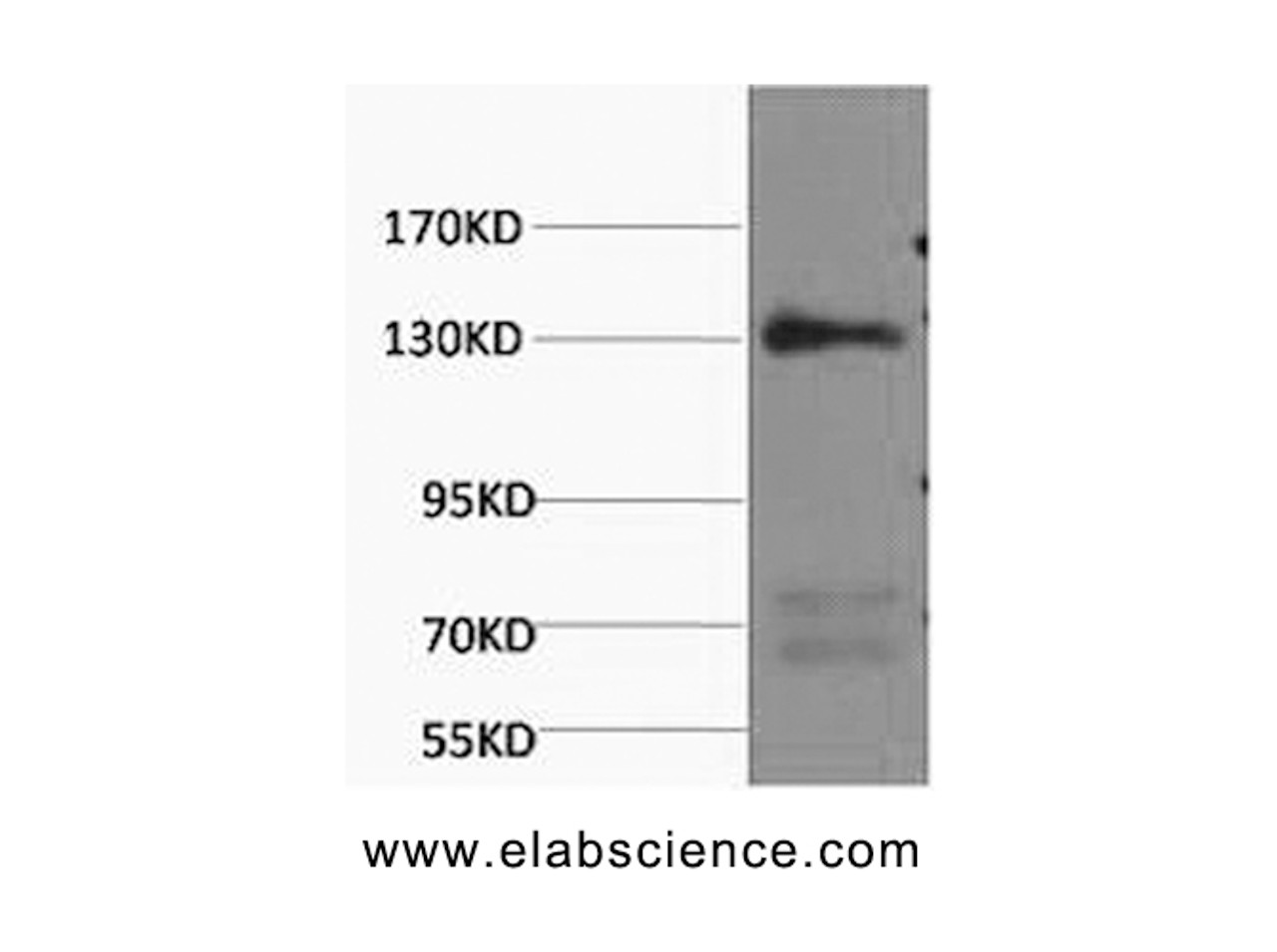 Western Blot analysis of Rat heart using NOS3 Monoclonal Antibody at dilution of 1:1000.