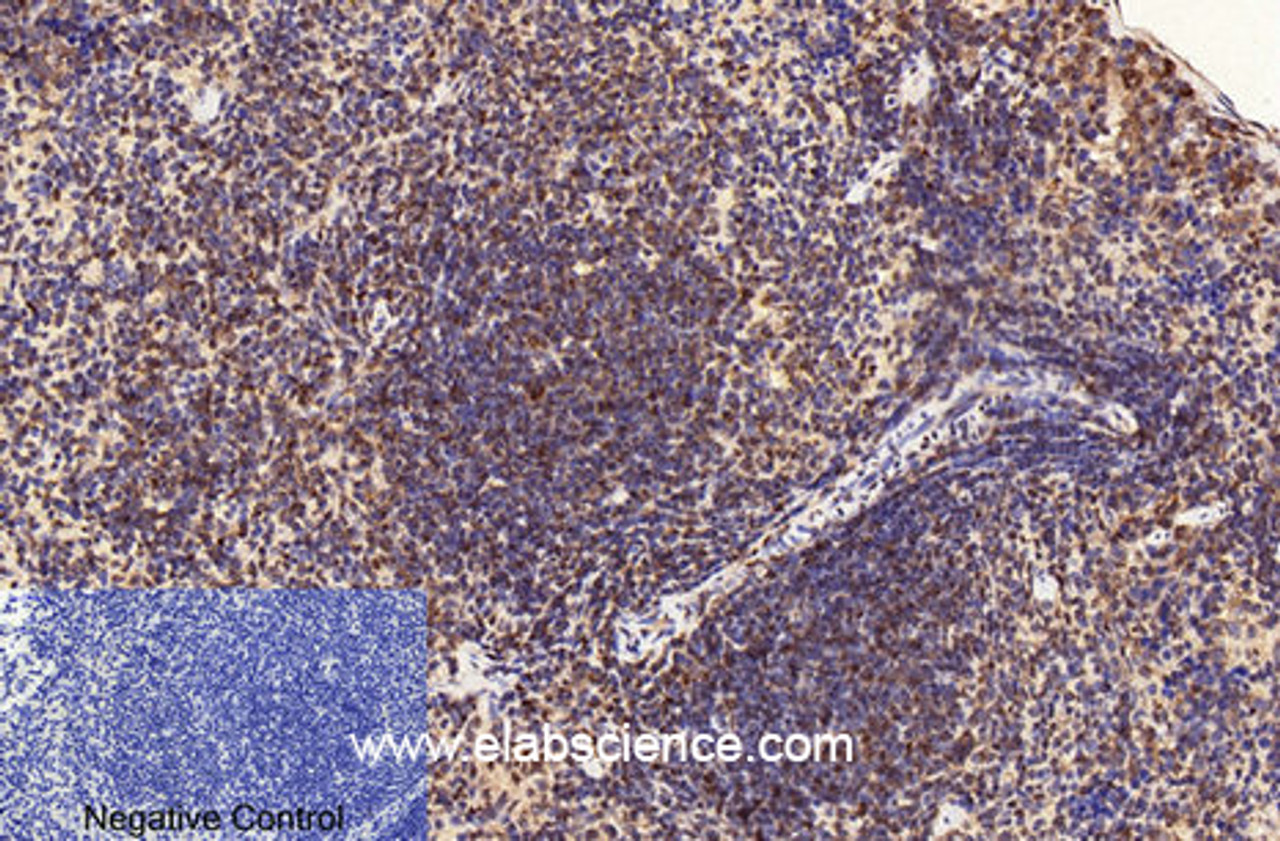 Immunohistochemistry of paraffin-embedded Mouse spleen tissue using CD2 Monoclonal Antibody at dilution of 1:200.