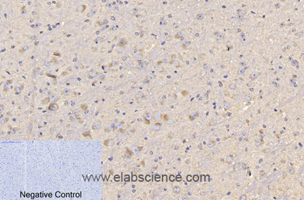 Immunohistochemistry of paraffin-embedded Mouse brain tissue using CD4 Monoclonal Antibody at dilution of 1:200.