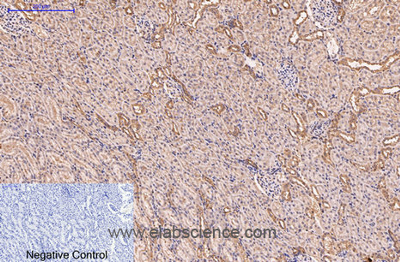 Immunohistochemistry of paraffin-embedded Rat kidney tissue using CD5 Monoclonal Antibody at dilution of 1:200.