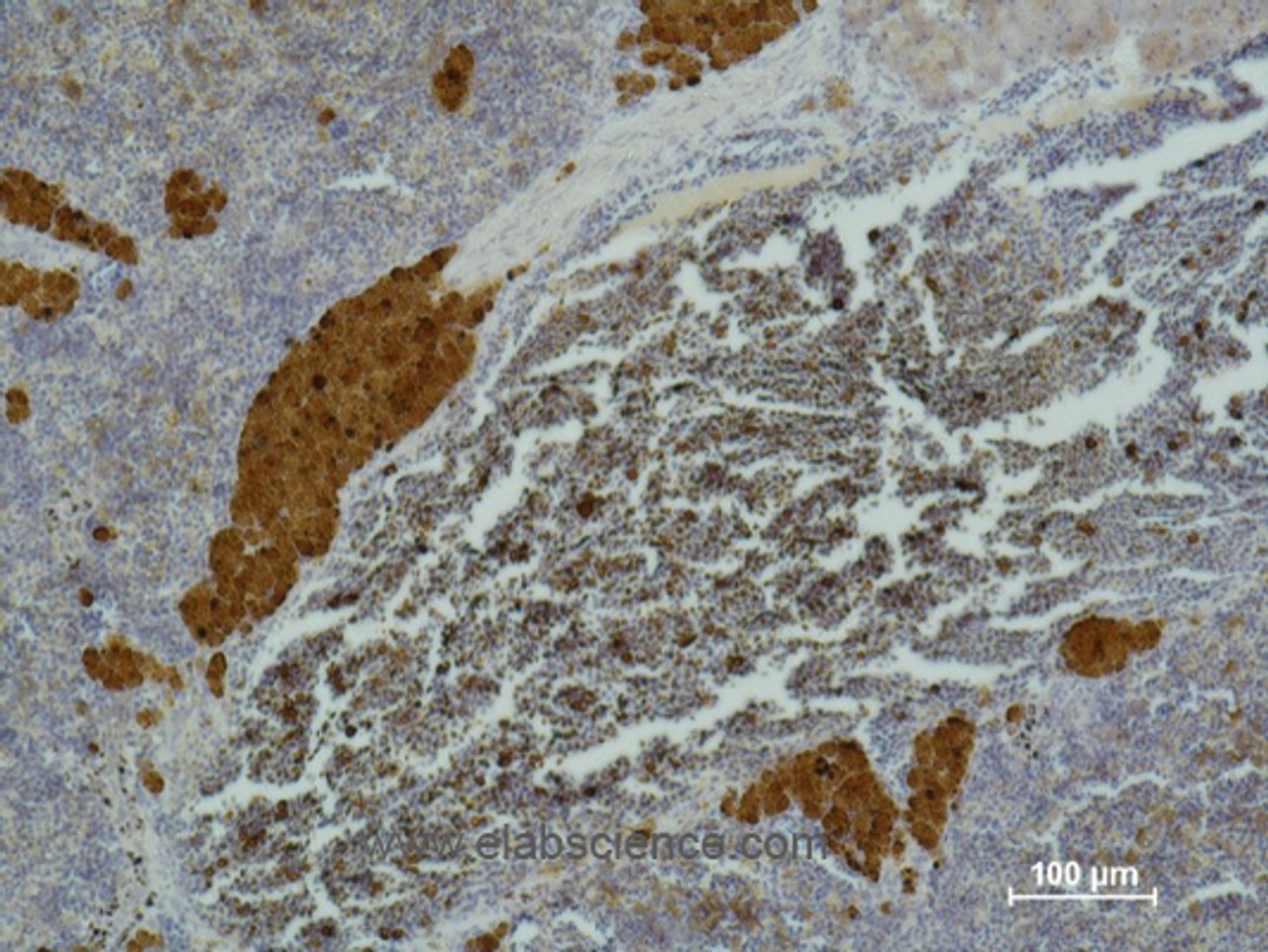 Immunohistochemistry of paraffin-embedded Mouse spleen tissue using IL2RA Monoclonal Antibody at dilution of 1:500
.