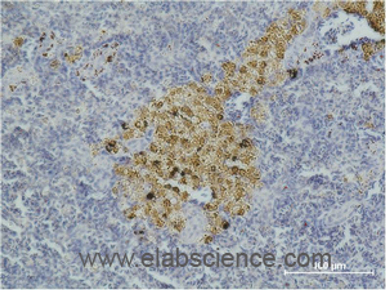 Immunohistochemistry of paraffin-embedded Mouse spleen tissue with CASP8 Monoclonal Antibody