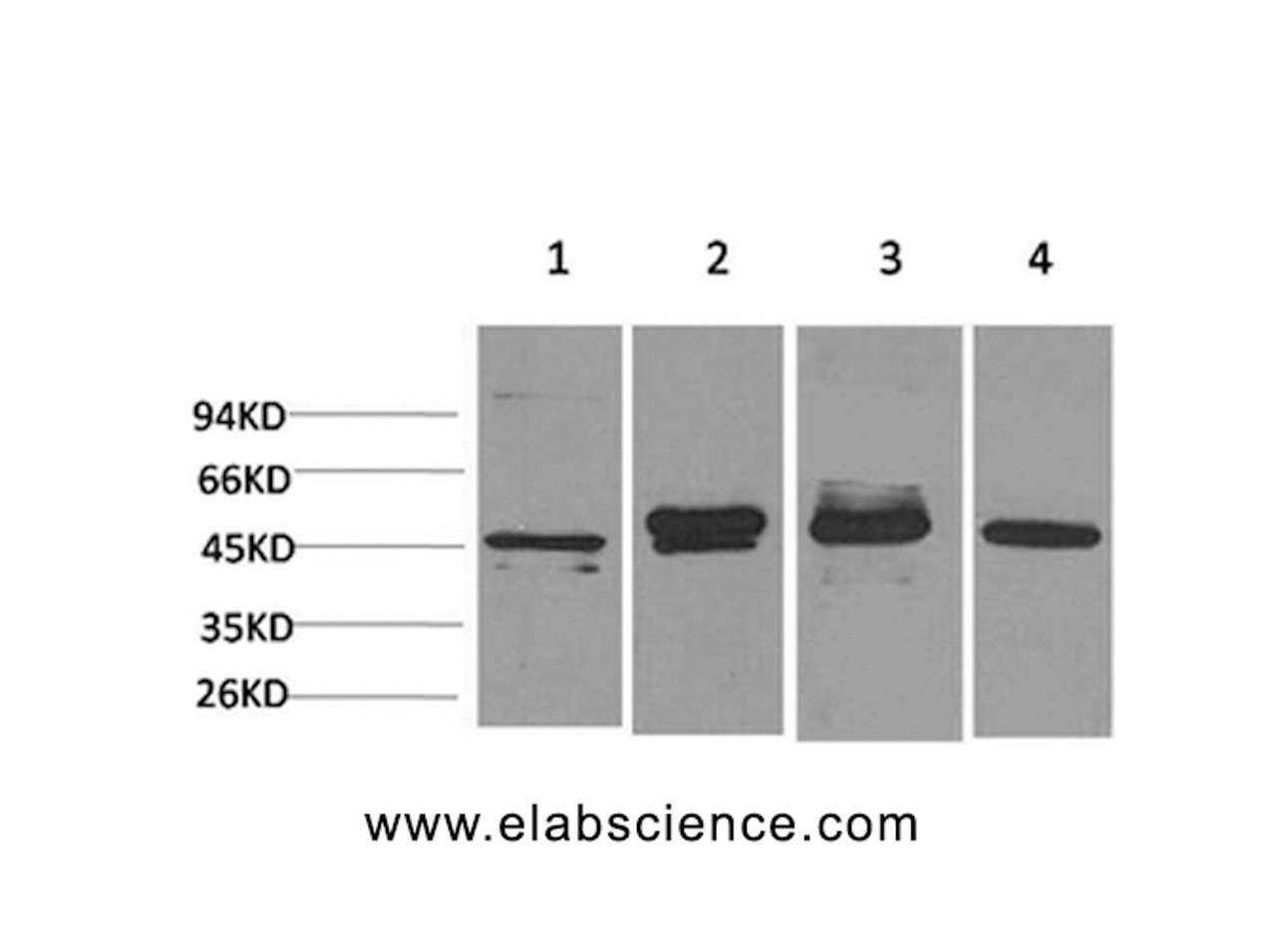 Western Blot analysis of 1) Hela, 2) 293T, 3) Mouse brain, 4) Rat brain with GAP43 Monoclonal Antibody