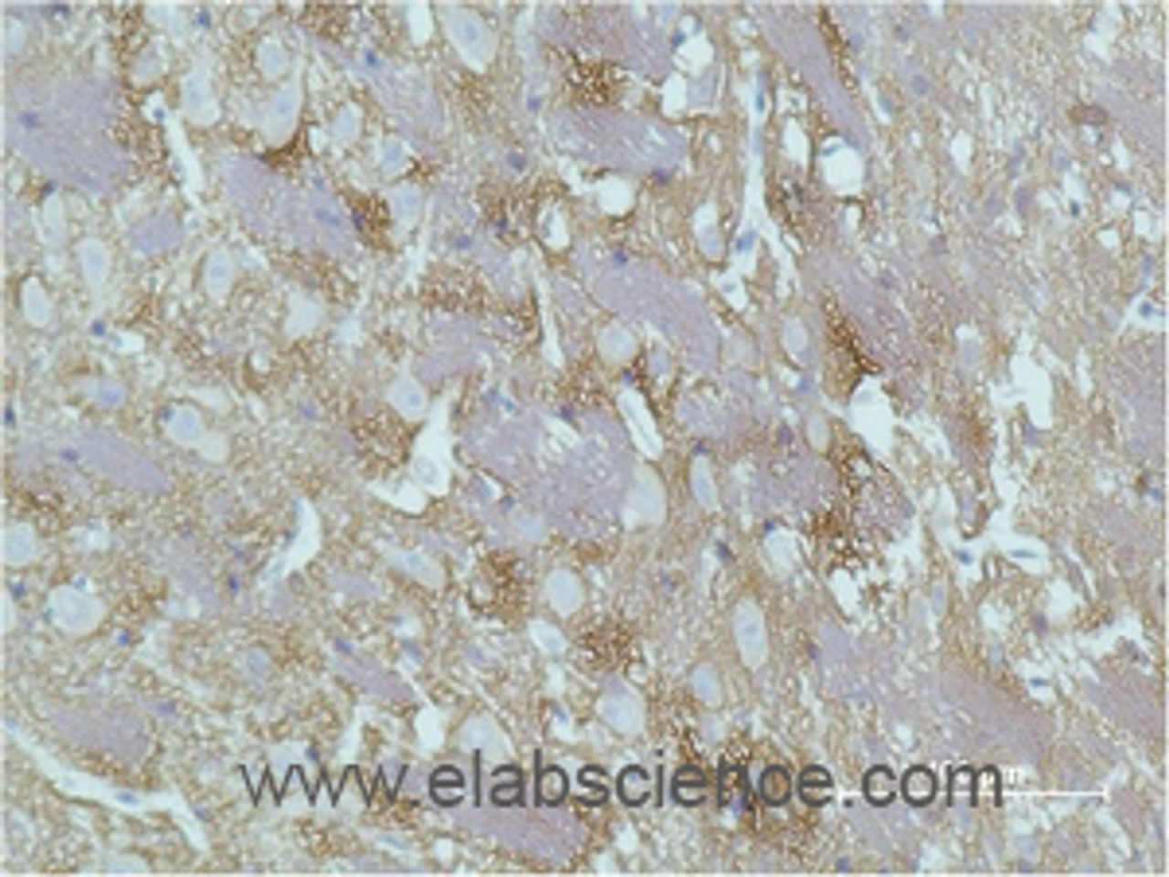 Immunohistochemistry of paraffin-embedded Rat brain tissue with GAP43 Monoclonal Antibody