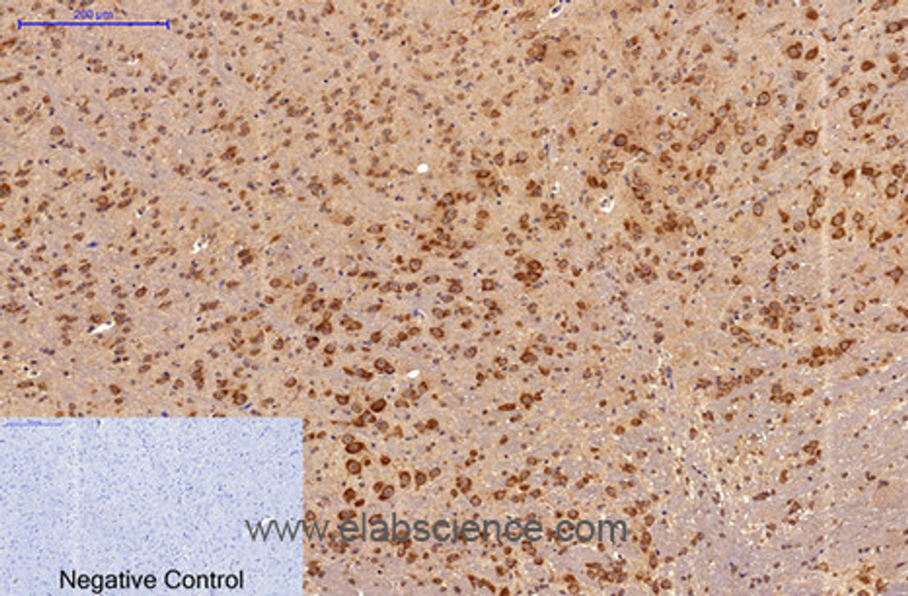 Immunohistochemistry of paraffin-embedded Mouse brain tissue using Survivin Monoclonal Antibody at dilution of 1:200.