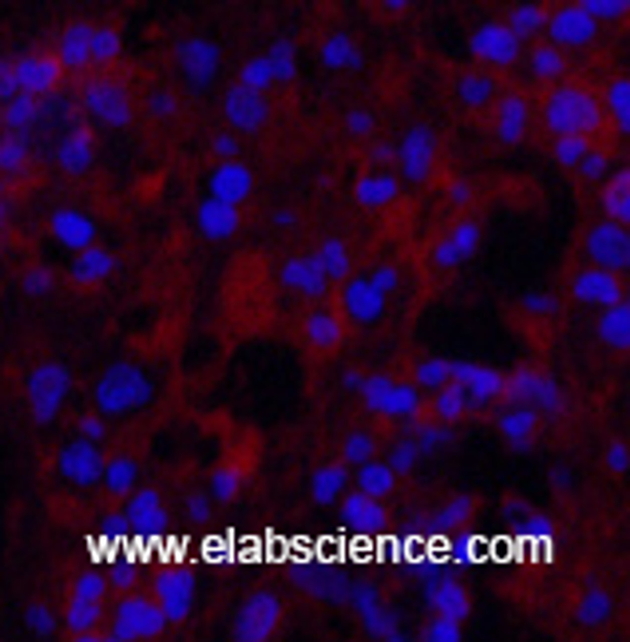 Immunofluorescence analysis of Human appendix tissue using MICU1 Monoclonal Antibody at dilution of 1:200.