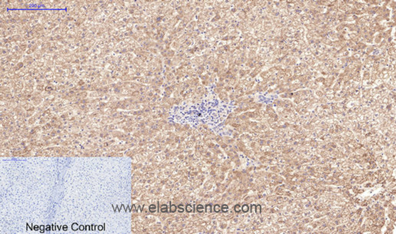 Immunohistochemistry of paraffin-embedded Human liver tissue using Active CASP3 Monoclonal Antibody at dilution of 1:200.