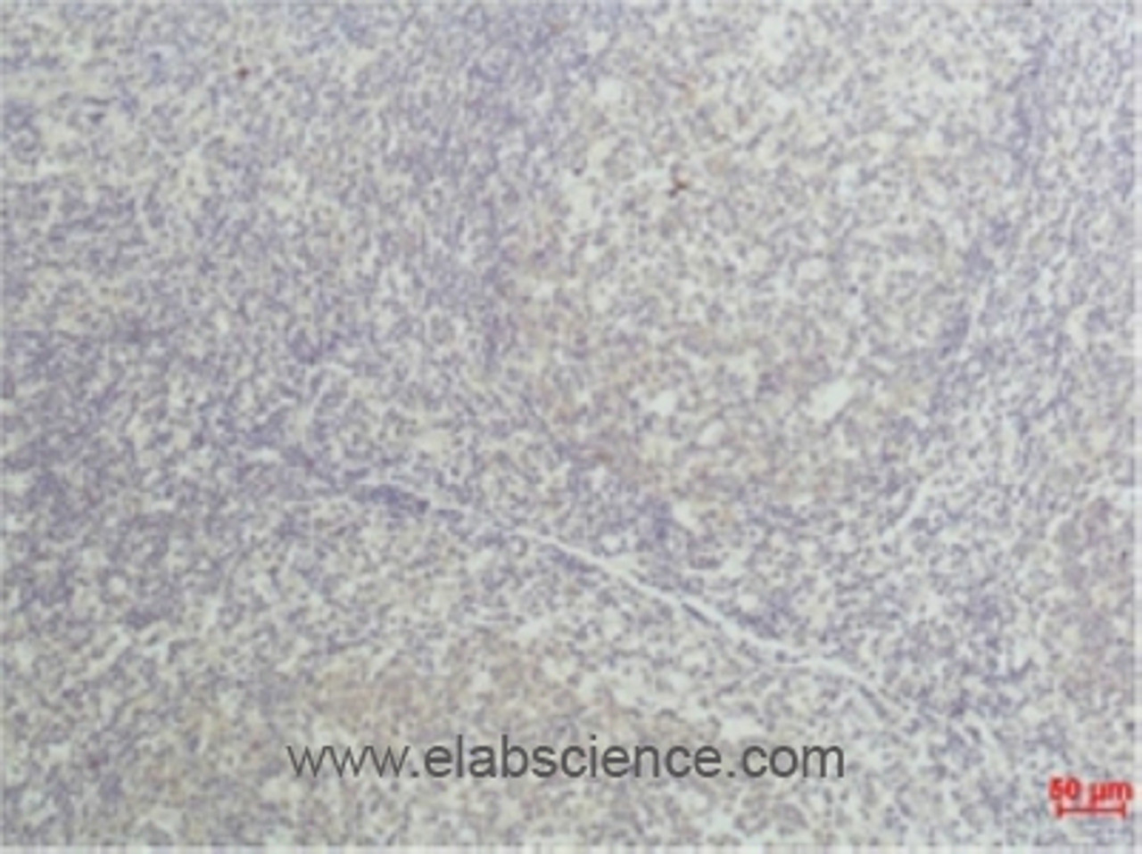 Immunohistochemical analysis of paraffin-embedded Human tonsil tissue using TNF alpha Monoclonal Antibody at dilution of 1:50.