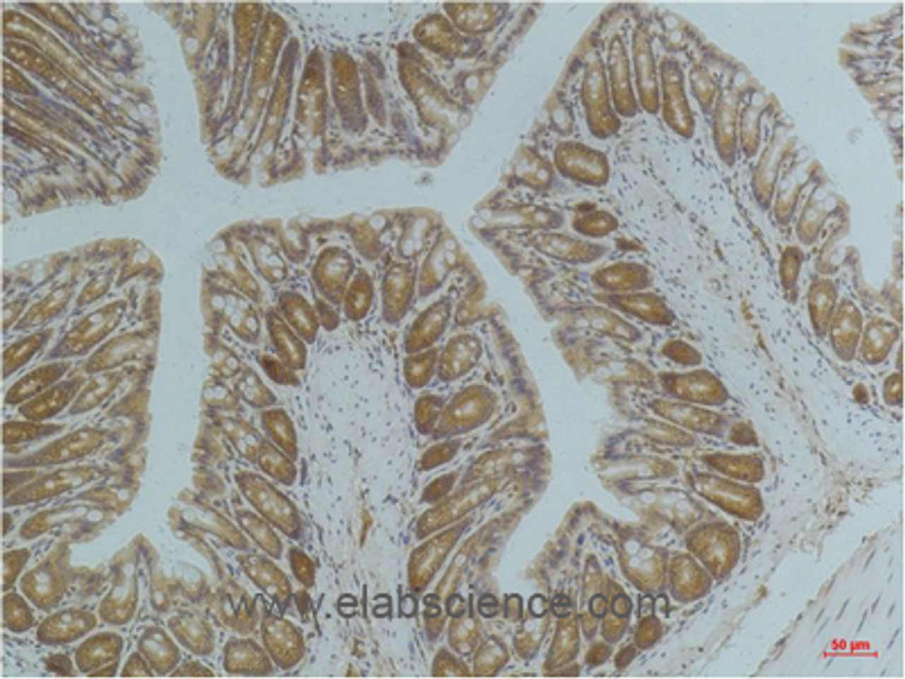 Immunohistochemistry of paraffin-embedded Mouse colon tissue using AMPK alpha1 Monoclonal Antibody at dilution of 1:200.