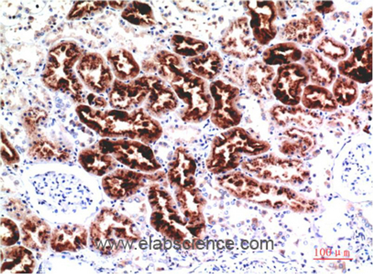 Immunohistochemistry of paraffin-embedded Human kidney tissue using CST3 Monoclonal Antibody at dilution of 1:200.