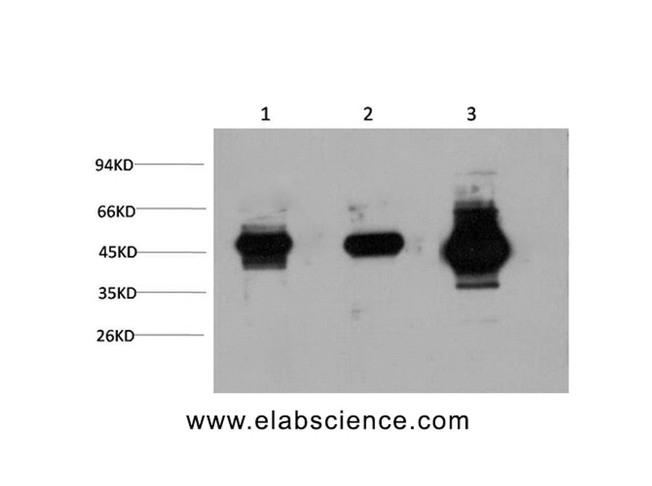 Western Blot analysis of 1) Hela, 2) 3T3, 3) Rat brain using GSK3 beta Monoclonal Antibody at dilution of 1:1000.