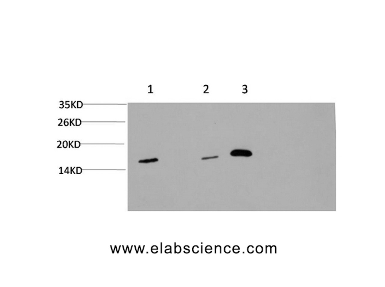 Western Blot analysis of 1) Hela, 2) 3T3, 3) Rat brain using MAP1LC3A Monoclonal Antibody at dilution of 1:1000.