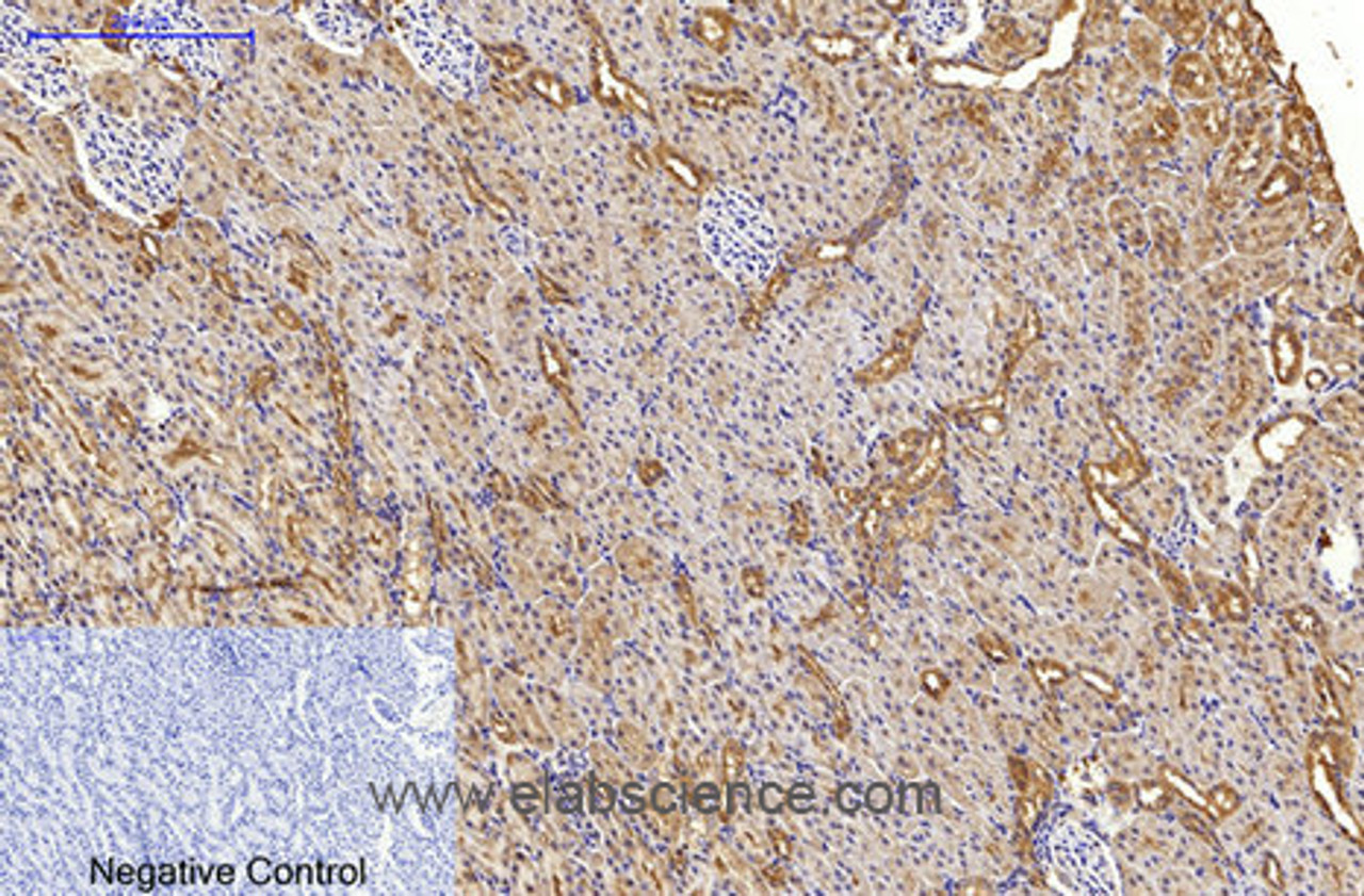 Immunohistochemistry of paraffin-embedded Rat kidney tissue using MAP1LC3A Monoclonal Antibody at dilution of 1:200.