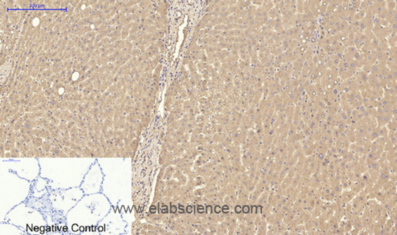 Immunohistochemistry of paraffin-embedded Human lung tissue using TTR Monoclonal Antibody at dilution of 1:200.