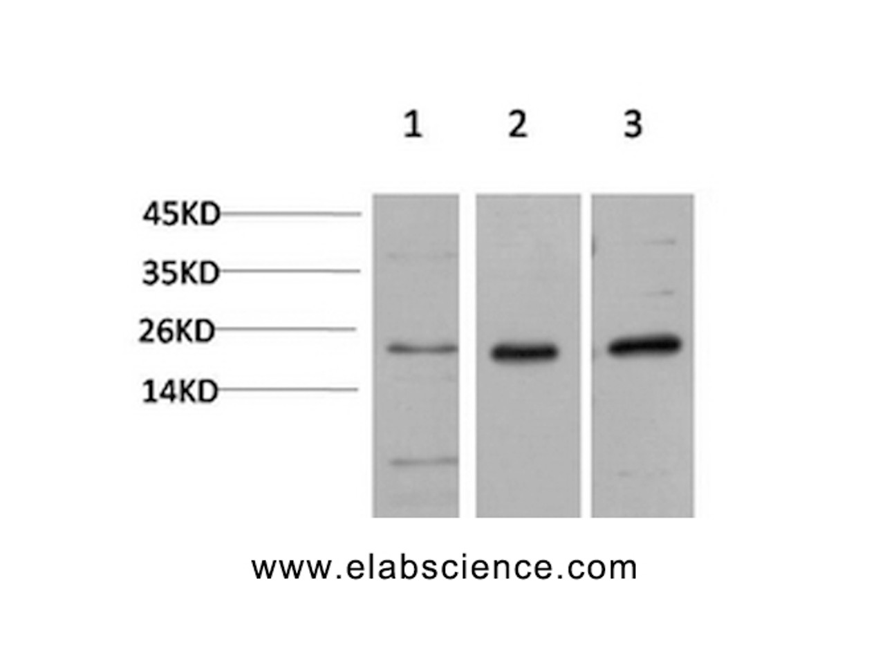 Western Blot analysis of 1) Hela, 2)3T3, 3) PC-12 cells using CBX5 Monoclonal Antibody at dilution of 1:1000.